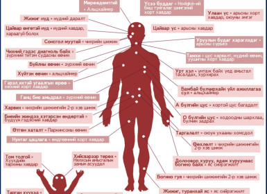 Өвчин тусах эрсдэлийг биеийн онцлогоор шинжих нь (1)